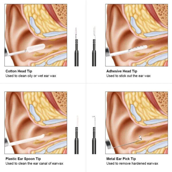 Smart Ear Endoscope Works with Phone & Computer - USB C - Image 5