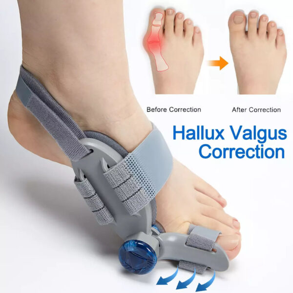 Bunion Fix Corrector - Image 6