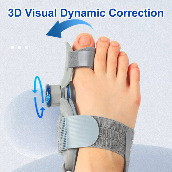 Bunion Fix Corrector - Image 4