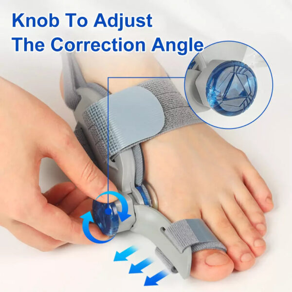 Bunion Fix Corrector - Image 5